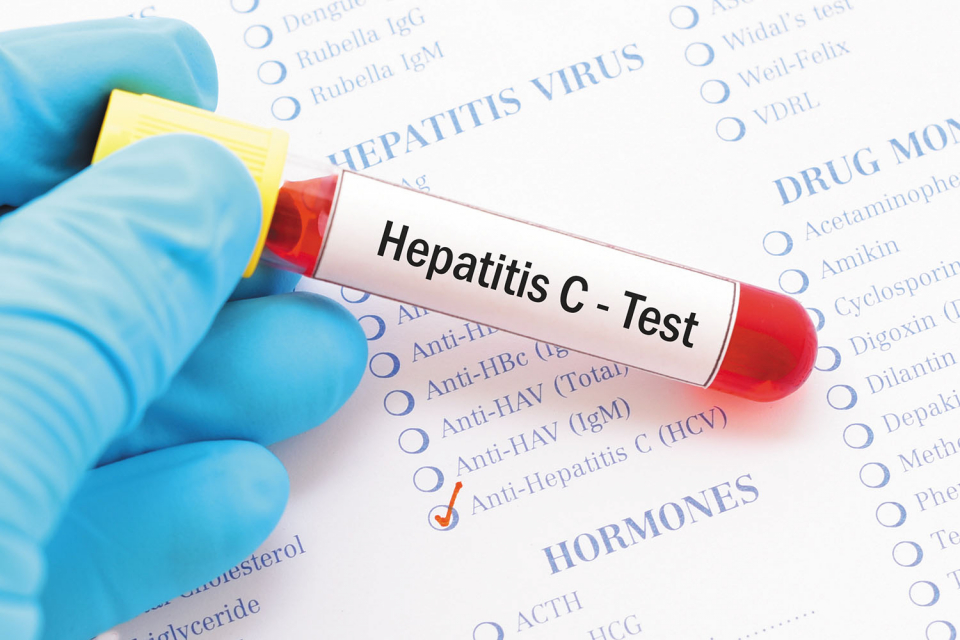 Сдружение „Айвър“, партньор на НЧ „Умение-2003“ - Ямбол в Гражданско обединение „Равни БГ“, организира безплатни тестове за хепатит С в цялата страна в...