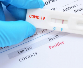 От днес се въвежда изискване на PCR тест за влизане в България