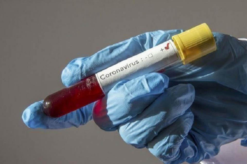 За изминалото денонощие за коронавирусна инфекция са изследвани 2896 проби. Според данните от Националния информационен портал, 165 от тях са дали положителен...