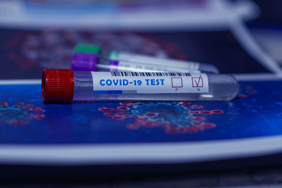 2760 е новият брой на регистрираните случаи на коронавирус у нас. Това означава ново рязко покачване на заразените за последното денонощие, сочат данните...
