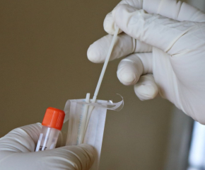 Още 8 положителни проби на коронавирус в област Ямбол