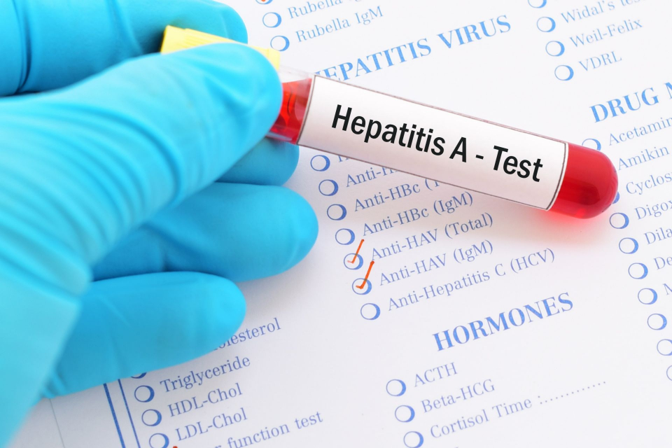 Повишена заболяемост от Вирусен хепатит тип А е регистрирана през м. октомври в три населени места в област Сливен. В с. Градец заболелите са 16, в с....