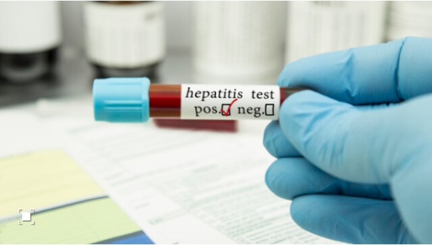 Проба при дете на 4 години у нас отговаря на критериите за острия хепатит, докладван от десетки страни. Това обяви пред NOVA директорът на Националния...