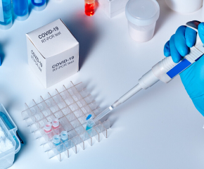 Здравната каса ще заплаща тестовете за антитела срещу COVID-19